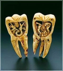 علاج آلام الأسنان بأسرع طرق منزلية Faster home remedies for toothache 266x300 علاج آلام الأسنان بأسرع طرق منزلية