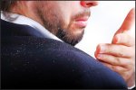 علاج قشرة الشعر علاج قشرة الشعر
