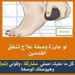 تشقق القدمين وطرق العلاج تشقق القدمين وطرق العلاج